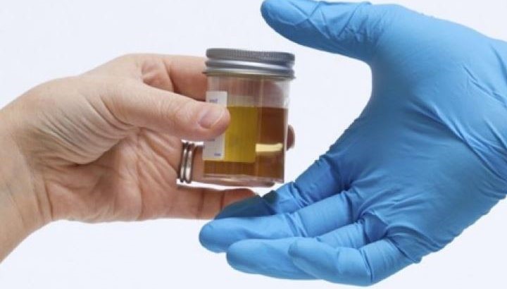 Synthetic Urine Pass 
      Dot Drug Test Iron Mountain Las Vegas NV